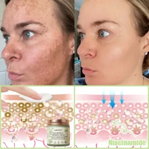 Jorondy® Firming Cream——Visibly Firms in Just 21 Days – Without Surgery or Irritation