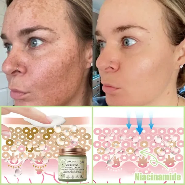 Jorondy® Firming Cream——Visibly Firms in Just 21 Days – Without Surgery or Irritation