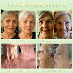 Jorondy® Firming Cream——Visibly Firms in Just 21 Days – Without Surgery or Irritation