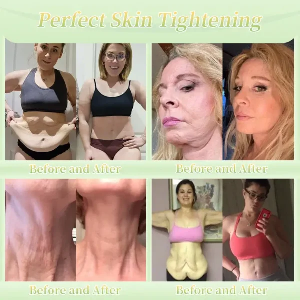 Jorondy® Firming Cream——Visibly Firms in Just 21 Days – Without Surgery or Irritation