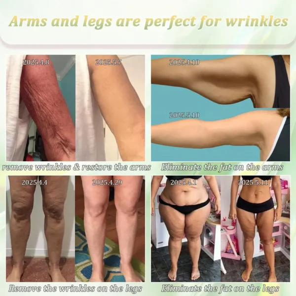 Jorondy® Firming Cream——Visibly Firms in Just 21 Days – Without Surgery or Irritation