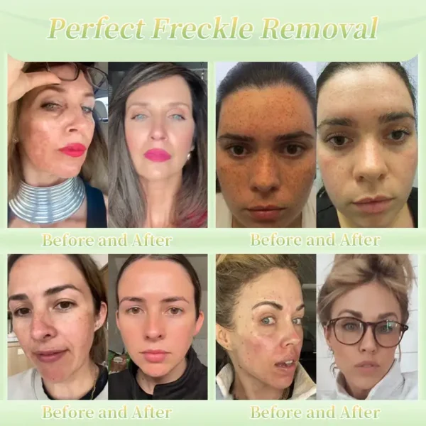 Jorondy® Firming Cream——Visibly Firms in Just 21 Days – Without Surgery or Irritation