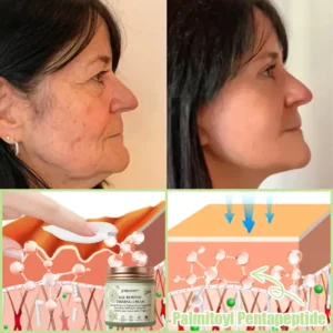 Jorondy® Firming Cream——Visibly Firms in Just 21 Days – Without Surgery or Irritation