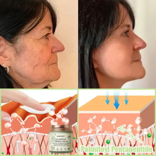 Jorondy® Firming Cream——Visibly Firms in Just 21 Days – Without Surgery or Irritation