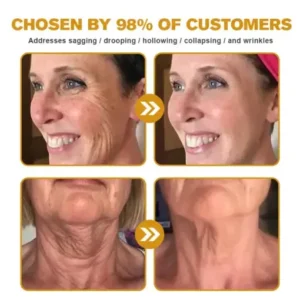 Jorondy® Instant skin tightening Cream
