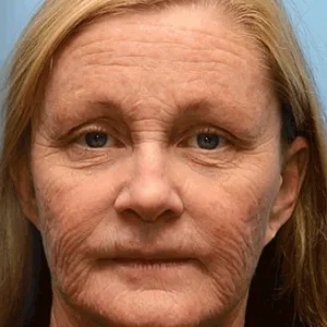 Jorondy® Instant skin tightening Cream