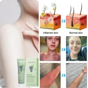Jorondy® Purifying Exfoliating Gel