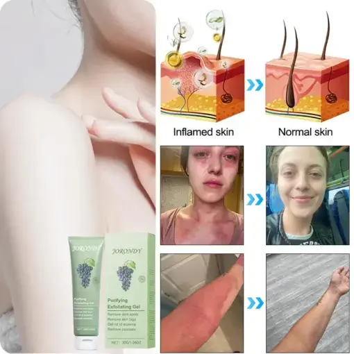 Jorondy® Purifying Exfoliating Gel