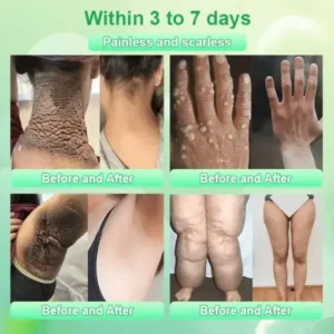 Jorondy® Purifying Exfoliating Gel