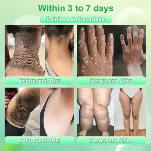 Jorondy® Purifying Exfoliating Gel