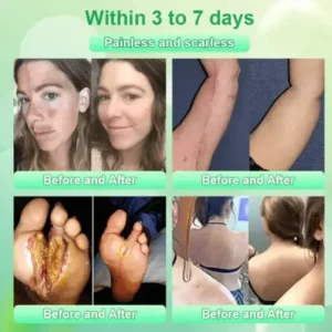 Jorondy® Purifying Exfoliating Gel