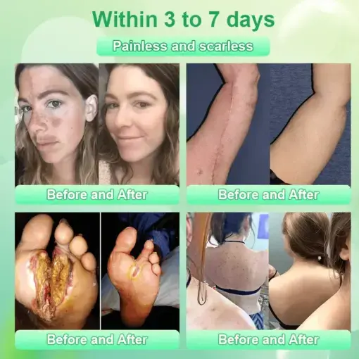 Jorondy® Purifying Exfoliating Gel