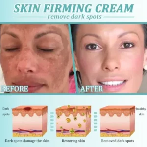 Jorondy® Skin Firming Cream