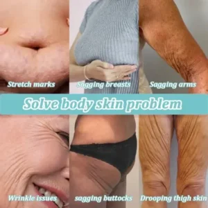 Jorondy® Skin Firming Cream