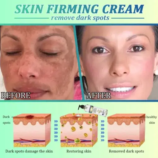 Jorondy® Skin Firming OIL