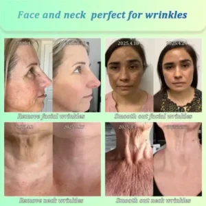 Jorondy® Skin Firming OIL