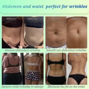 Jorondy® Skin Firming OIL