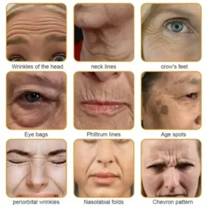Jorondy® Skin Treatment Cream