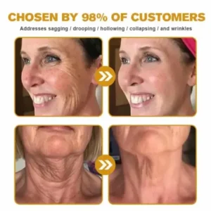 Jorondy® Skin Treatment Cream