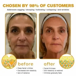 Jorondy® Skin Treatment Cream