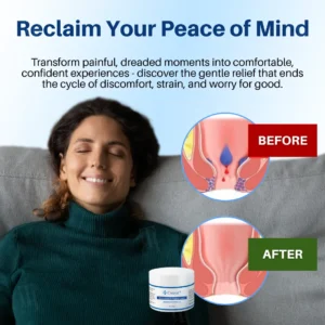 Cvreoz® Hemorrhoid & Fissure Cream