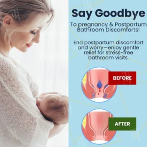 Cvreoz® Herbal Hemorrhoid Treatment Anal Spray + Wipes