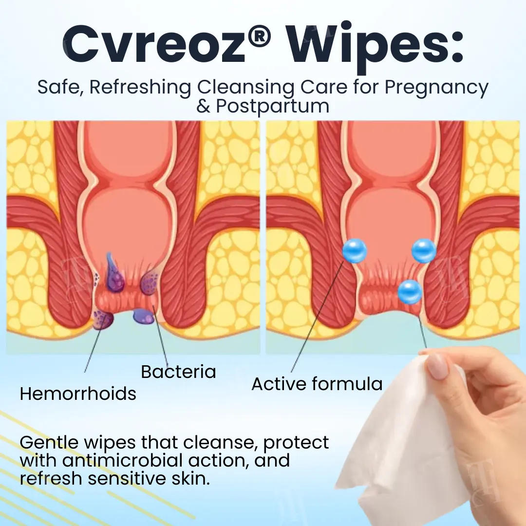 Cvreoz® Herbal Hemorrhoid Treatment Anal Spray + Wipes