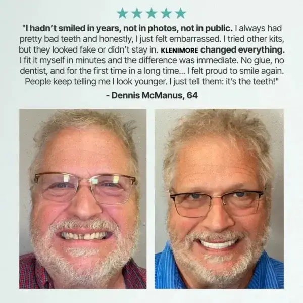 KLENIMORE™ Custom-Fit Fully Functional Dentures for a More Confident Smile!