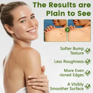 Timilk® ThujaClear Botanical Wart Cream